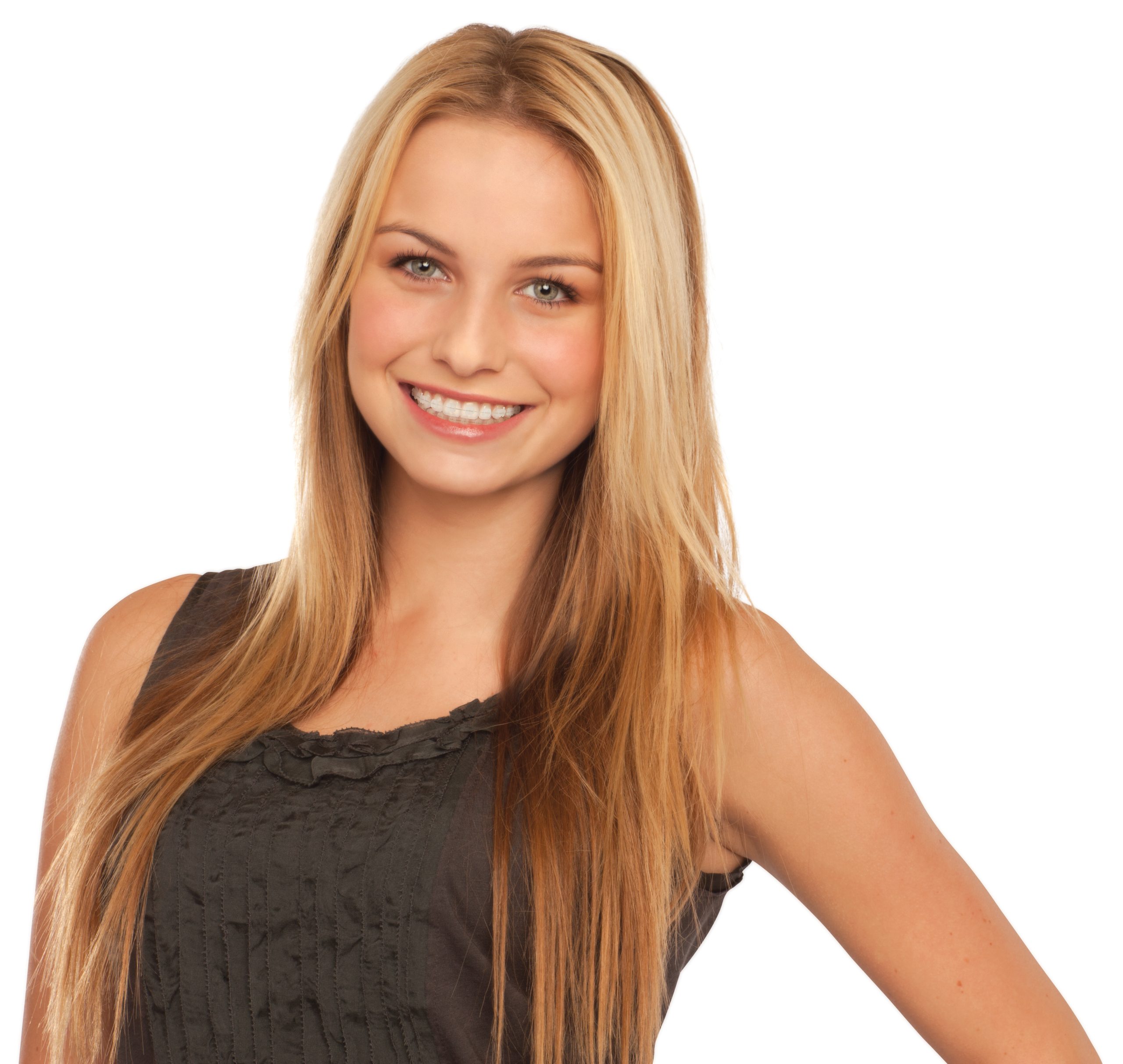https://friscospremierortho.com/wp-content/uploads/2023/12/ClarityADV-blond-model-HR-scaled.jpg